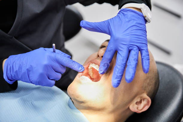 Best Emergency Dental Care for Broken or Chipped Teeth in Rutherford, TN